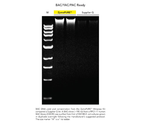 ZymoPURE Plasmid Miniprep Kit