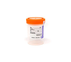 Plastic urine collection cup for collecting urine specimens.